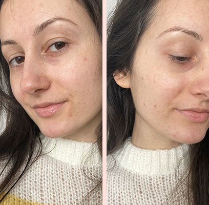Серум за лице Home Spa